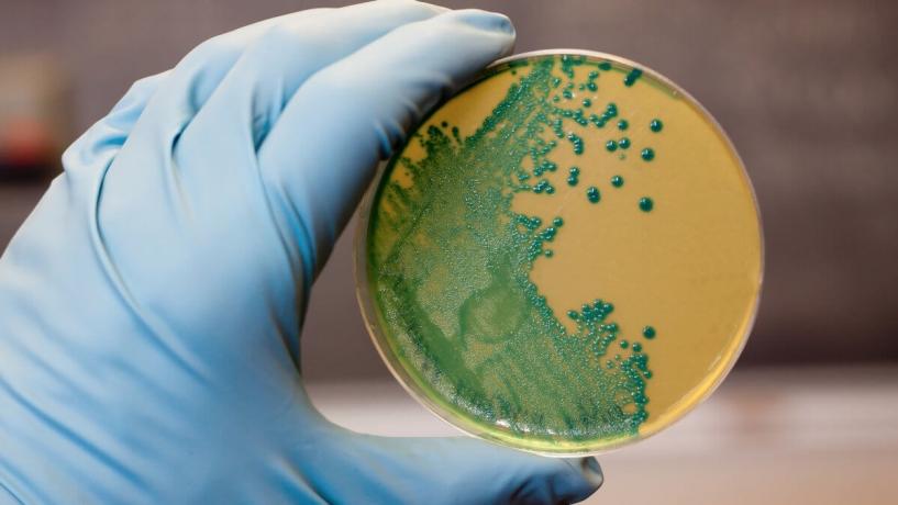 A Lesson in Listeria - Everything You Need to Know