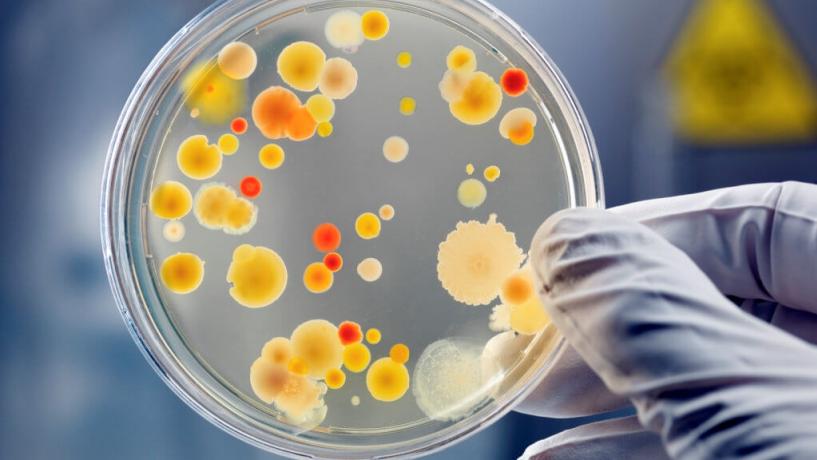 Four Bacteria Breeding Grounds Right in Your Home